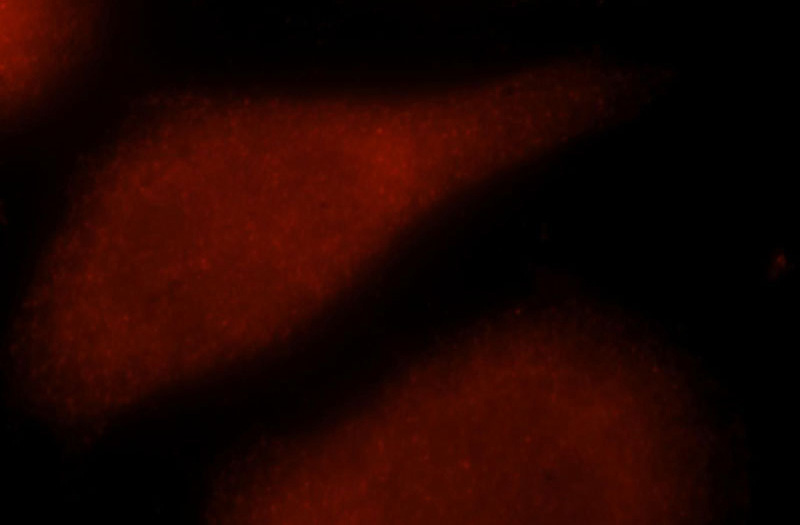 Immunofluorescent analysis of MCF-7 cells, using SMAD5 antibody Catalog No:115421 at 1:25 dilution and Rhodamine-labeled goat anti-rabbit IgG (red).