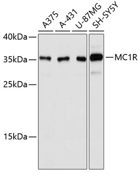 Western blot - MC1R Monoclonal Antibody 
