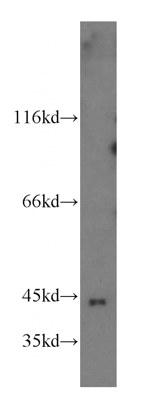 Jurkat cells were subjected to SDS PAGE followed by western blot with Catalog No:111245(GTPBP5 antibody) at dilution of 1:500