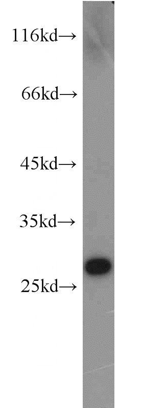 human brain tissue were subjected to SDS PAGE followed by western blot with Catalog No:111182(GSTA4 antibody) at dilution of 1:1200