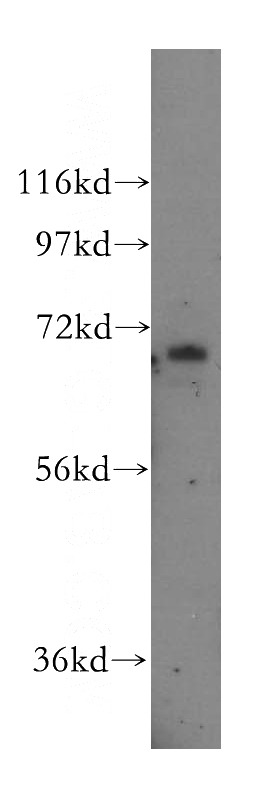 HepG2 cells were subjected to SDS PAGE followed by western blot with Catalog No:116949(ZNF143 antibody) at dilution of 1:800