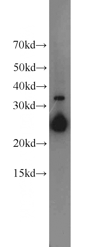 HEK-293 cells were subjected to SDS PAGE followed by western blot with Catalog No:109231(CHMP1A antibody) at dilution of 1:500