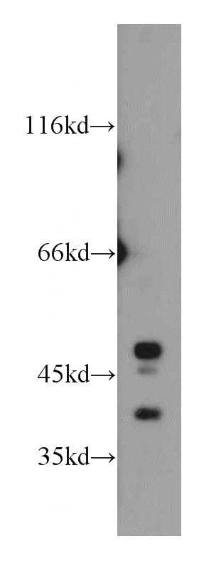 HEK-293 cells were subjected to SDS PAGE followed by western blot with Catalog No:113646(PECI antibody) at dilution of 1:500