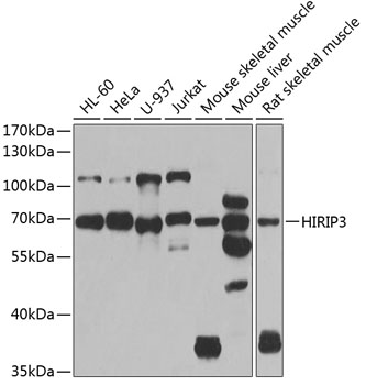 Western blot - HIRIP3 Polyclonal Antibody 