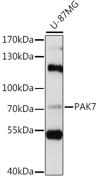 Western blot - PAK5 Polyclonal Antibody 