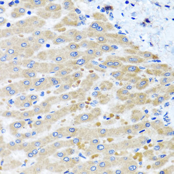 Immunohistochemistry - DARS2 Polyclonal Antibody 