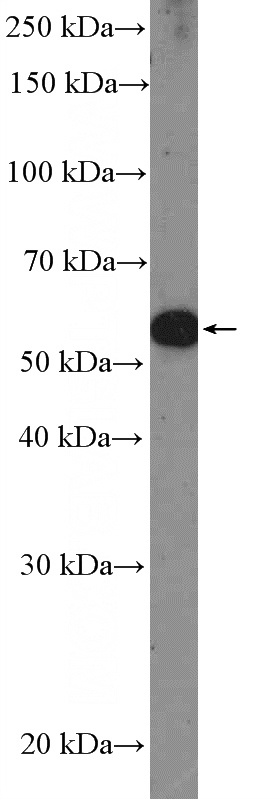 mouse skin tissue were subjected to SDS PAGE followed by western blot with Catalog No:113605(PAX3 Antibody) at dilution of 1:300