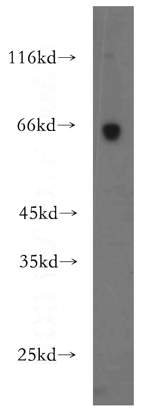 human brain tissue were subjected to SDS PAGE followed by western blot with Catalog No:117065(ZKSCAN3 antibody) at dilution of 1:500