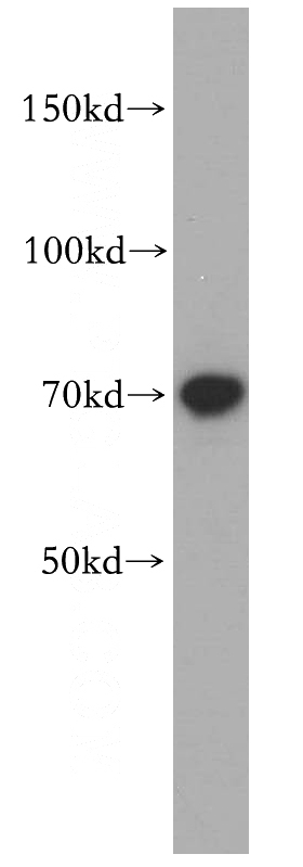 PC-3 cells were subjected to SDS PAGE followed by western blot with Catalog No:114869(RUFY2 antibody) at dilution of 1:1500