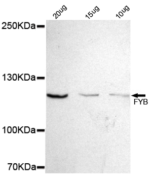 Western blot detection of FYB in 10,15 and 20ug Jurkat cell lysate using FYB mouse mAb (1:500 diluted).Predicted band size:120KDa.Observed band size:120KDa.