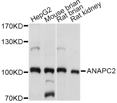 Western blot - ANAPC2 Polyclonal Antibody 