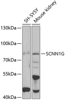 Western blot - SCNN1G Polyclonal Antibody 