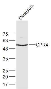 Fig1: Sample:; Cerebrum (Mouse) Lysate at 40 ug; Primary: Anti-GPR4 at 1/300 dilution; Secondary: IRDye800CW Goat Anti-Rabbit IgG at 1/20000 dilution; Predicted band size: 41 kD; Observed band size: 51 kD