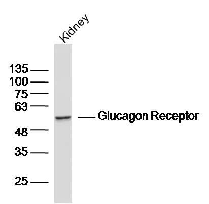 Fig5: Sample:Kidney (Mouse) Lysate at 40 ug; Primary: Anti-Glucagon Receptor at 1/300 dilution; Secondary: IRDye800CW Goat Anti-Rabbit IgG at 1/20000 dilution; Predicted band size: 51kD; Observed band size: 51kD