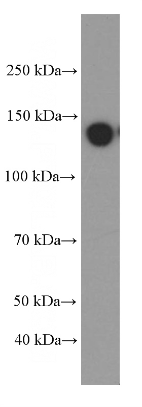 HepG2 cells were subjected to SDS PAGE followed by western blot with Catalog No:107280(IGF1R-Specific Antibody) at dilution of 1:2000
