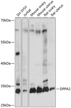 Western blot - DPPA2 Polyclonal Antibody 