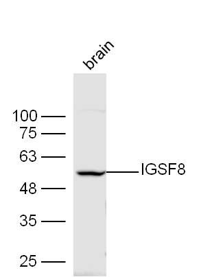 Fig2: Sample: Brain(Mouse) lysate at 30ug;; Primary: Anti-IGSF8 at 1:300 dilution;; Secondary: HRP conjugated Goat-Anti-rabbit IgG(bs-0295G-HRP) at 1: 5000 dilution ;; Predicted band size: 62 kD; Observed band size: 55 kD