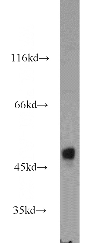 HEK-293 cells were subjected to SDS PAGE followed by western blot with Catalog No:107871(GLA antibody) at dilution of 1:1500