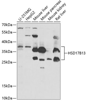 Western blot - HSD17B13 Polyclonal Antibody 