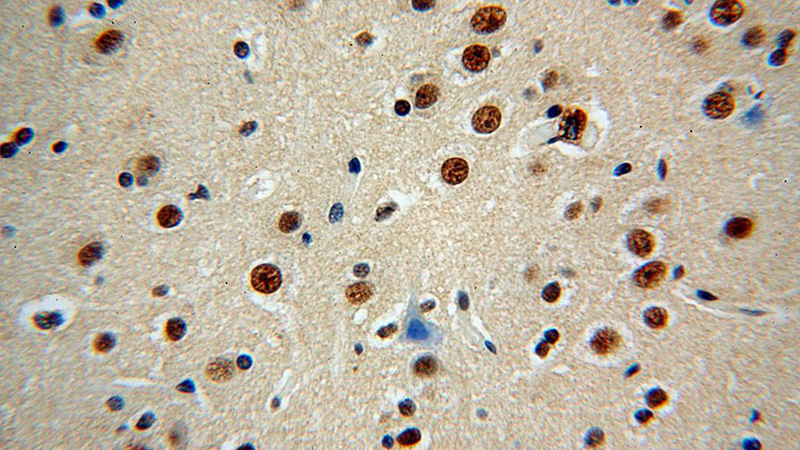 Immunohistochemical of paraffin-embedded human brain using Catalog No:109525(CPSF2 antibody) at dilution of 1:100 (under 40x lens)
