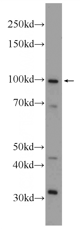 fetal human brain tissue were subjected to SDS PAGE followed by western blot with Catalog No:108973(CCDC40 Antibody) at dilution of 1:1000