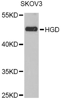 Western blot - HGD Polyclonal Antibody 