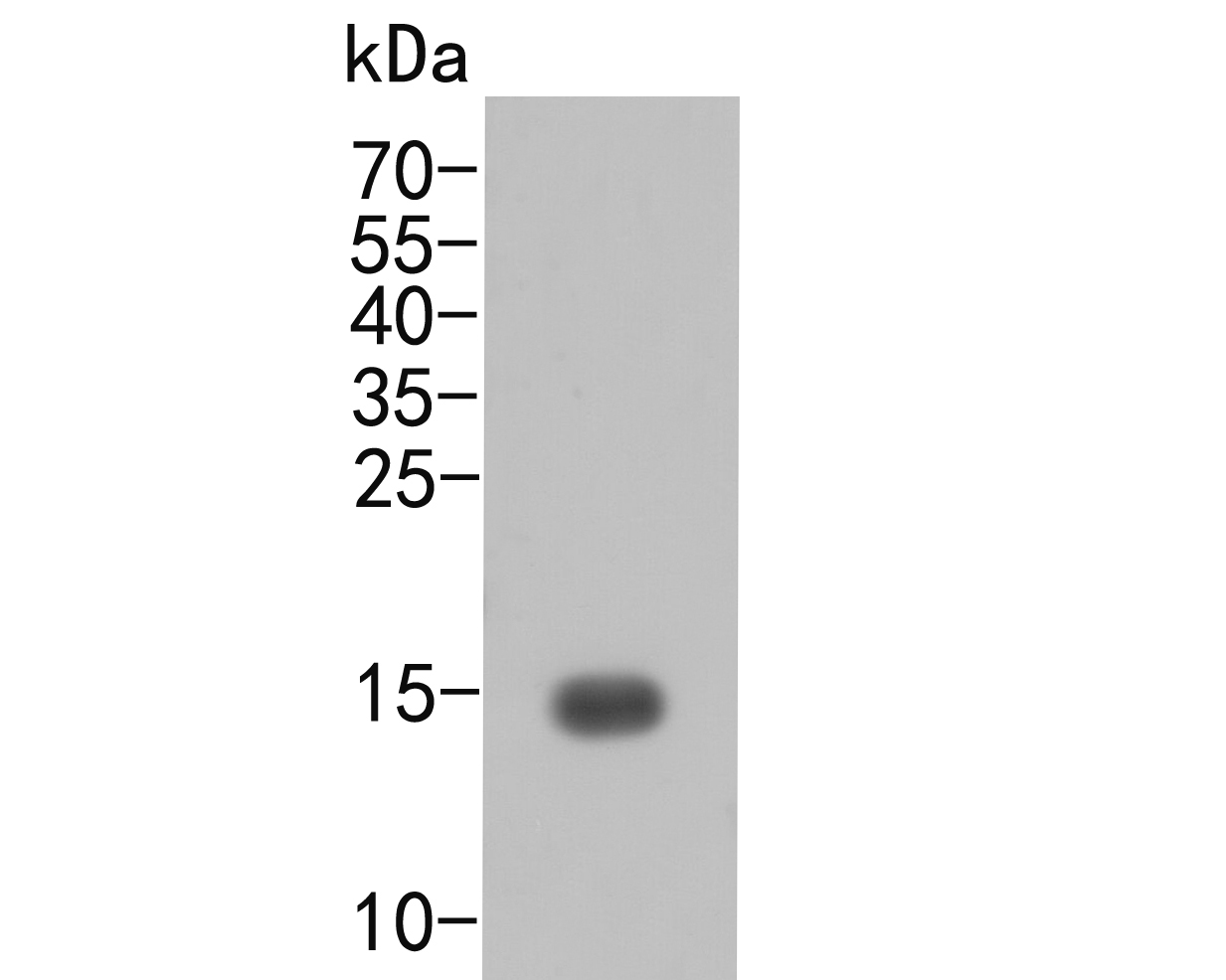 Fig1:; Western Blot analysis of recombinant murine TNF-alpha using rabbit TNF alpha antibody.; Western blot analysis of TNF alpha on recombinant protein lysate. Proteins were transferred to a PVDF membrane and blocked with 5% BSA in PBS for 1 hour at room temperature. The primary antibody ( 1/1000) was used in 5% BSA at room temperature for 2 hours. Goat Anti-Rabbit IgG - HRP Secondary Antibody (HA1001) at 1:5,000 dilution was used for 1 hour at room temperature.