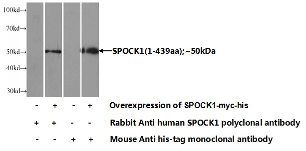 Transfected HEK-293 cells were subjected to SDS PAGE followed by western blot with Catalog No:115578(SPocK1 Antibody) at dilution of 1:1000