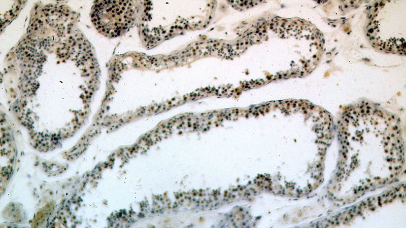 Immunohistochemical of paraffin-embedded human testis using Catalog No:114622(REXO4,REX4 antibody) at dilution of 1:100 (under 10x lens)