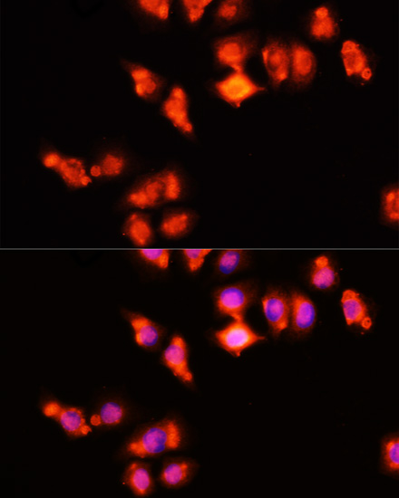 Immunofluorescence - HOXA11 Polyclonal Antibody 