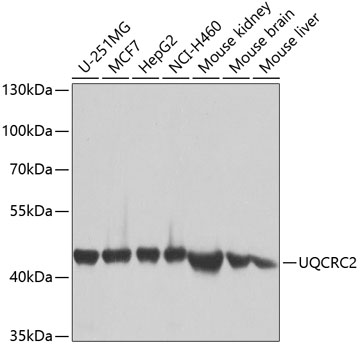 Western blot - UQCRC2 Polyclonal Antibody 