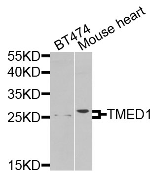 Western blot - TMED1 Polyclonal Antibody 