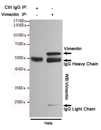 Immunoprecipitation analysis of Hela cell lysates using Vimentin mouse mAb.