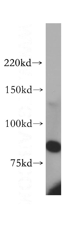 human rectum tissue were subjected to SDS PAGE followed by western blot with Catalog No:113946(PLCD1 antibody) at dilution of 1:400