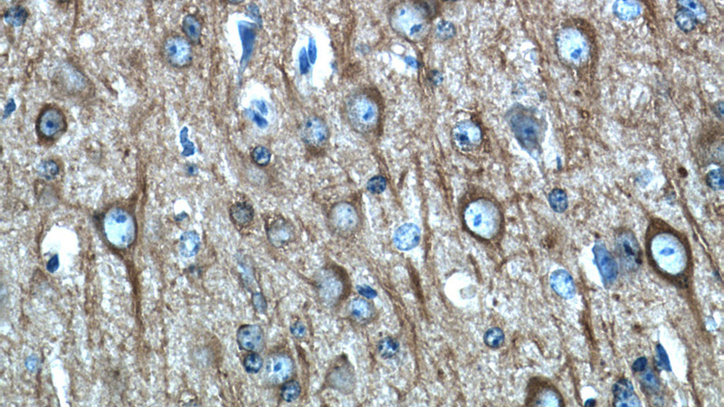 Immunohistochemistry of paraffin-embedded mouse brain tissue slide using Catalog No:117306(Tubulin-beta Antibody) at dilution of 1:50 (under 40x lens)