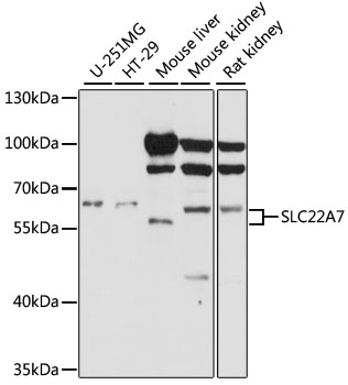 Western blot - SLC22A7 Polyclonal Antibody 