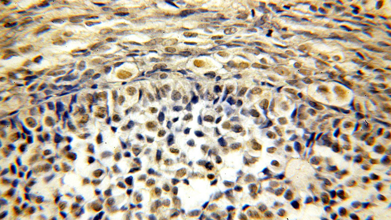 Immunohistochemical of paraffin-embedded human ovary using Catalog No:107707(ACTL6A antibody) at dilution of 1:50 (under 40x lens)