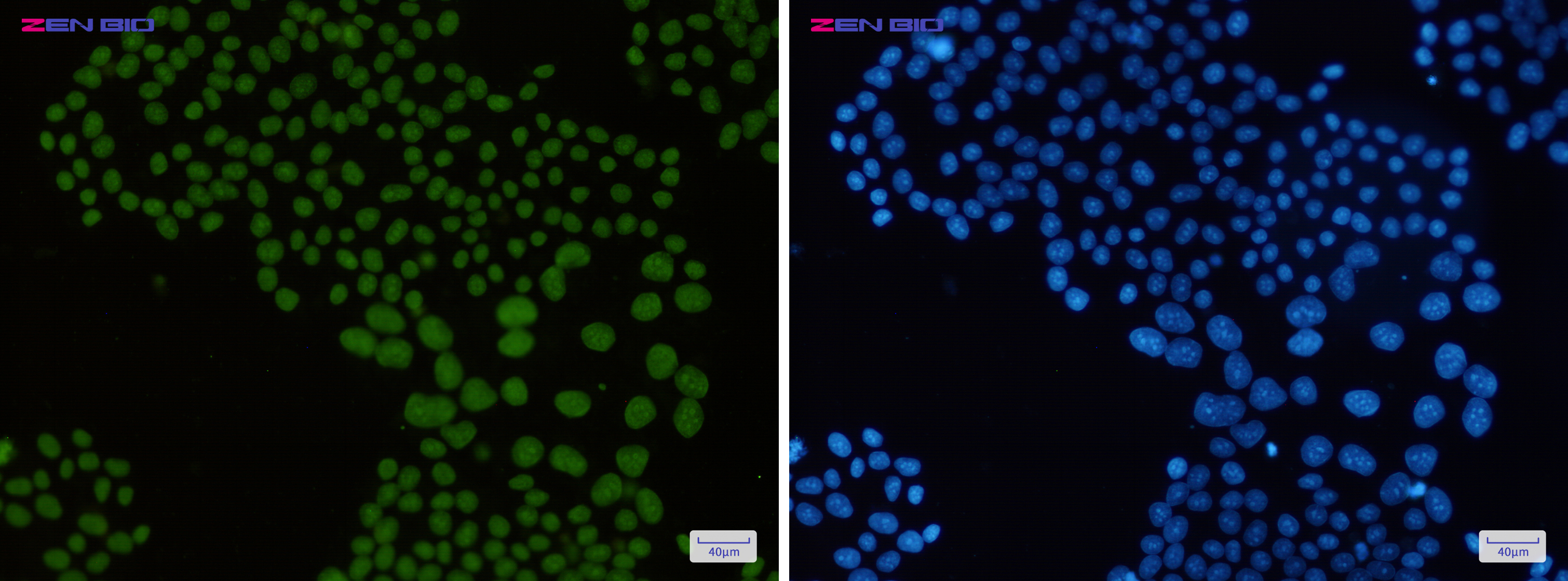 Immunocytochemistry of macroH2A.1(green) in Hela cells using macroH2A.1 Rabbit pAb at dilution 1/50, and DAPI(blue)