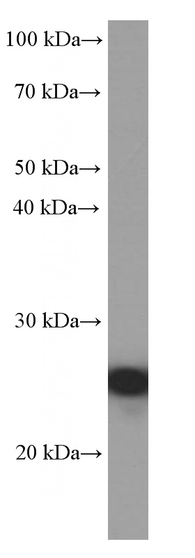 Jurkat cells were subjected to SDS PAGE followed by western blot with Catalog No:107080(BCL2 Antibody) at dilution of 1:4000