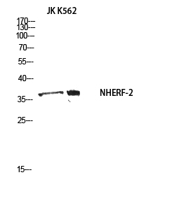 Fig1:; Western blot analysis of JK K562 using NHERF-2 antibody.. Secondary antibody（catalog#：HA1001) was diluted at 1:20000