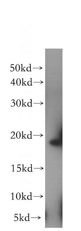 HeLa cells were subjected to SDS PAGE followed by western blot with Catalog No:110174(EIF1AX antibody) at dilution of 1:400