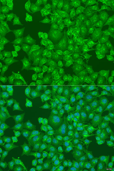 Immunofluorescence - DCP2 Polyclonal Antibody 