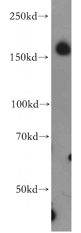 human brain tissue were subjected to SDS PAGE followed by western blot with Catalog No:113114(NEO1-Specific antibody) at dilution of 1:500