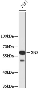 Western blot - GNS Polyclonal Antibody 