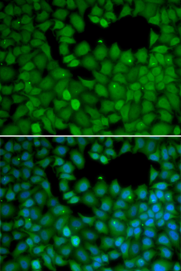 Immunofluorescence - NET1 Polyclonal Antibody 