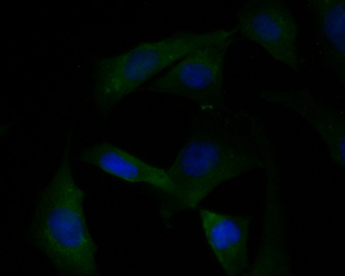 Fig3: ICC staining of KCNK18 in SHG-44 cells (green). Formalin fixed cells were permeabilized with 0.1% Triton X-100 in TBS for 10 minutes at room temperature and blocked with 1% Blocker BSA for 15 minutes at room temperature. Cells were probed with the primary antibody ( 1/100) for 1 hour at room temperature, washed with PBS. Alexa Fluor®488 Goat anti-Rabbit IgG was used as the secondary antibody at 1/1,000 dilution. The nuclear counter stain is DAPI (blue).