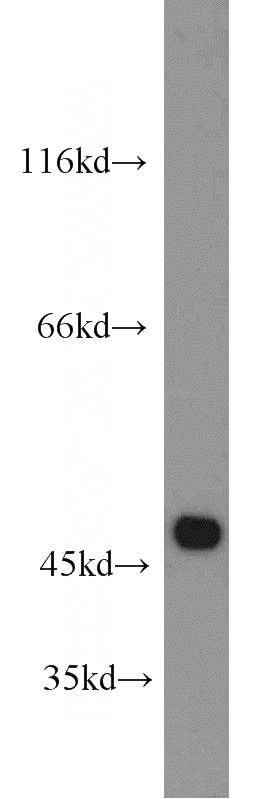 human brain tissue were subjected to SDS PAGE followed by western blot with Catalog No:112451(MARCKSL1 antibody) at dilution of 1:600