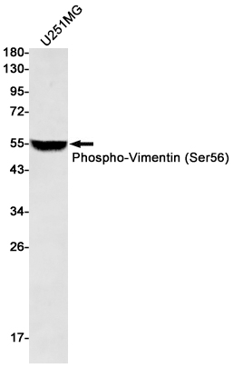 Western blot detection of Phospho-Vimentin (Ser56) in U251MG cell lysates using Phospho-Vimentin (Ser56) Rabbit mAb(1:500 diluted).Predicted band size:54kDa.Observed band size:54kDa.