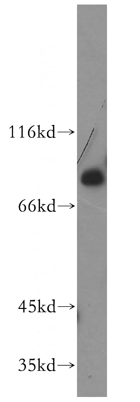 HeLa cells were subjected to SDS PAGE followed by western blot with Catalog No:112573(MDM4 antibody) at dilution of 1:500