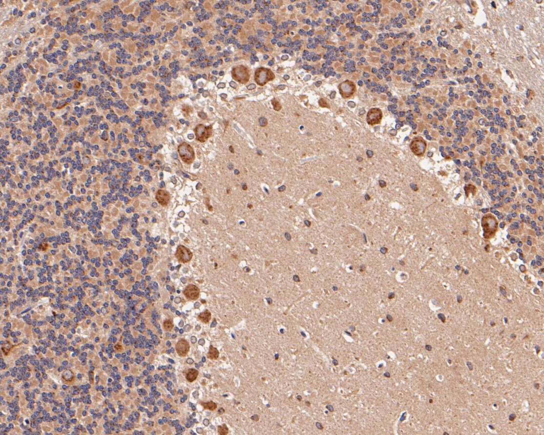 Fig3:; Immunohistochemical analysis of paraffin-embedded rat cerebellar tissue using anti-KCNN2 antibody. The section was pre-treated using heat mediated antigen retrieval with Tris-EDTA buffer (pH 8.0-8.4) for 20 minutes.The tissues were blocked in 5% BSA for 30 minutes at room temperature, washed with ddH; 2; O and PBS, and then probed with the primary antibody ( 1/100) for 30 minutes at room temperature. The detection was performed using an HRP conjugated compact polymer system. DAB was used as the chromogen. Tissues were counterstained with hematoxylin and mounted with DPX.